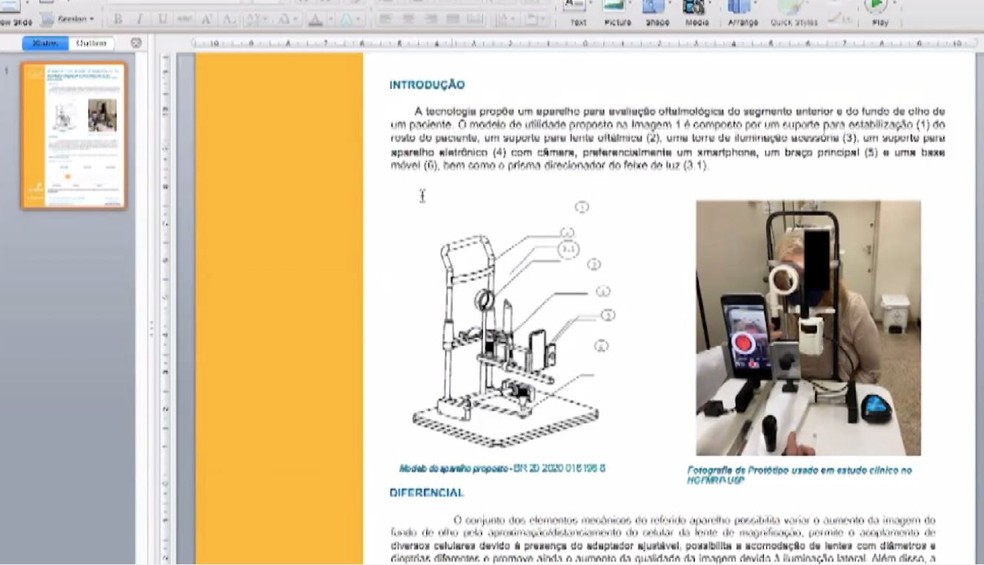 Dispositivo criado pela USP Ribeirão Preto para examinar olhos de pacientes com celular — Foto: Reprodução/EPTV