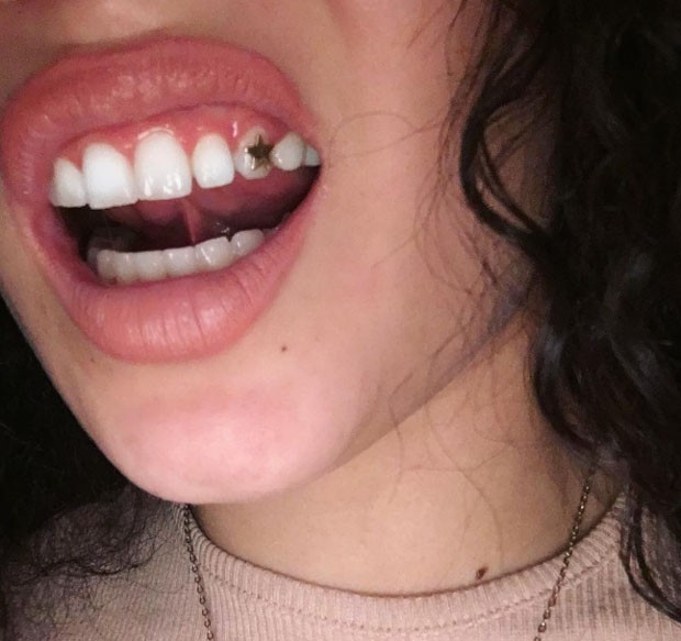 Dente (Foto: Reprodução / Instagram)