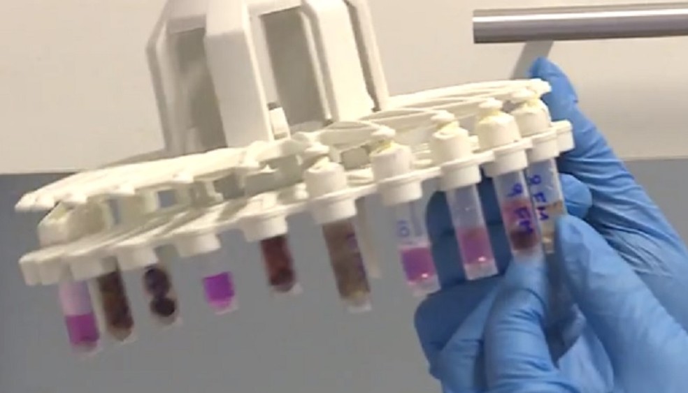 Amostras de testes de Covid-19 — Foto: TV Globo / Reprodução