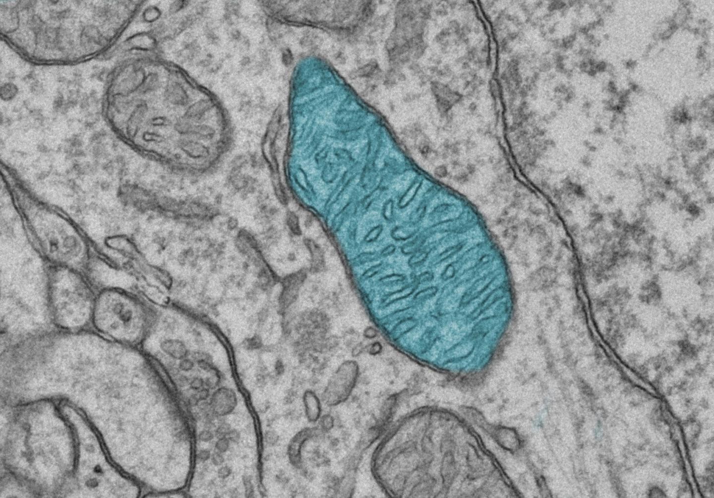 Micrografia eletrônica de cérebro de camundongo. Mitocôndria aparece destacada em azul (Foto: Mikaela Laine/PLOS Genetics)