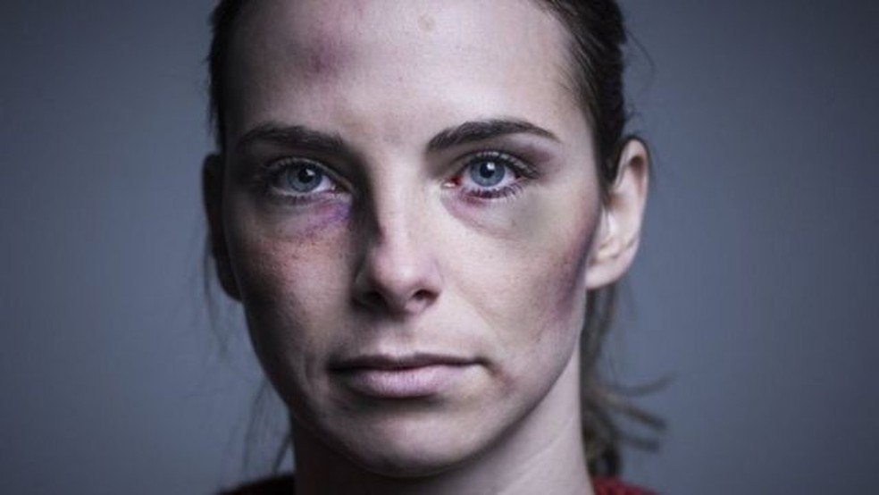 O impacto duradouro do controle coercitivo não é tão visível quanto uma cicatriz ou hematoma — Foto: Getty Images via BBC