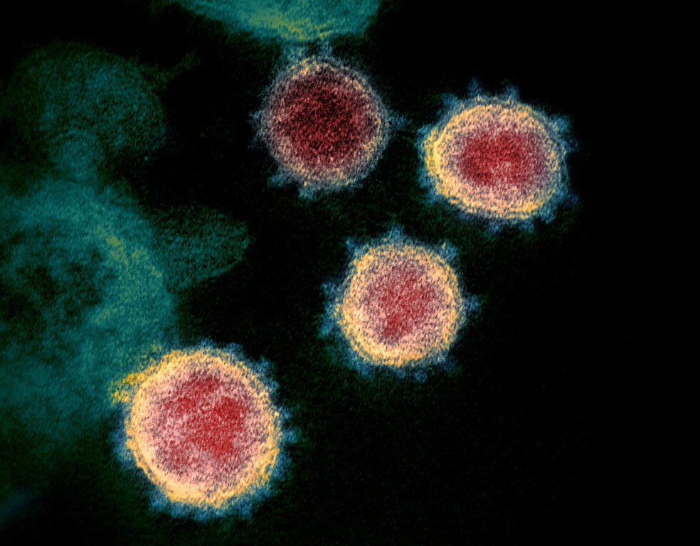 Coronavírus Sars-Cov-2 em imagem de microscópio eletrônico — Foto: NIAID-RML/Handout via Reuters