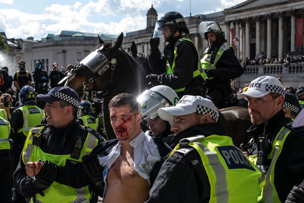 Protestos contra o racismo deixam feridos em Londres (Foto: Getty Images)