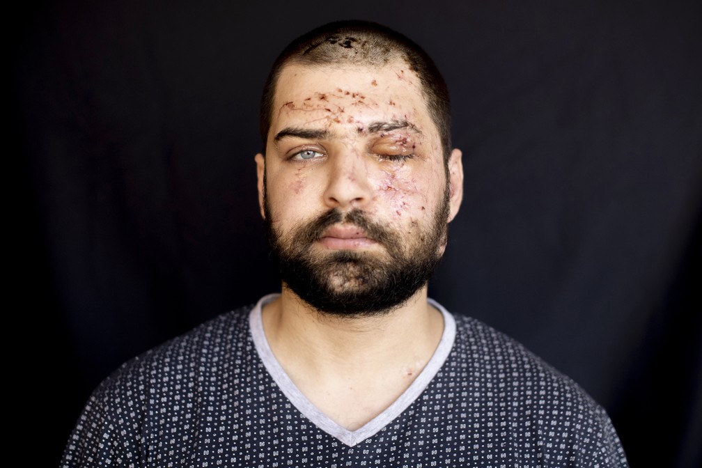 Hassan Nabha, 27, engenheiro de computação e comunicação, ferido em seu escritório durante explosão do dia 4 de agosto em Beirute, no Líbano — Foto: Hassan Ammar/AP