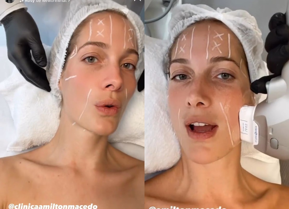 Schynaider Moura faz tratamento estético (Foto: Reprodução/Instagram)