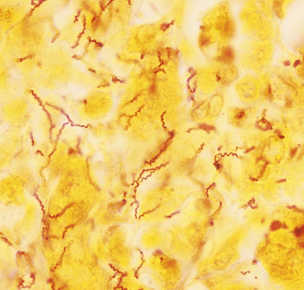 A bactéria causadora da sífilis vista no microscópio (Foto: Getty Images)