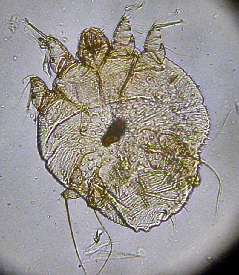 Uma fotomicrografia do ácaro causador da sarna (Sarcoptes scabiei) (Foto: Wikipedia)
