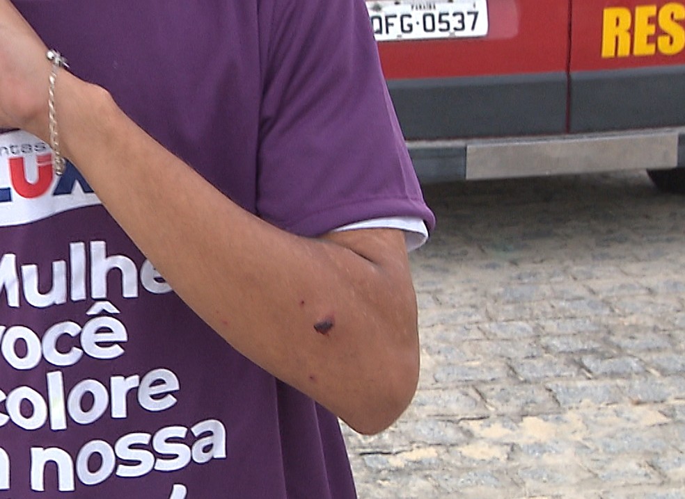 Torcedor do Treze que estava na arquibancada foi atingido de rasp�o � Foto: Reprodu��o/TV Para�ba