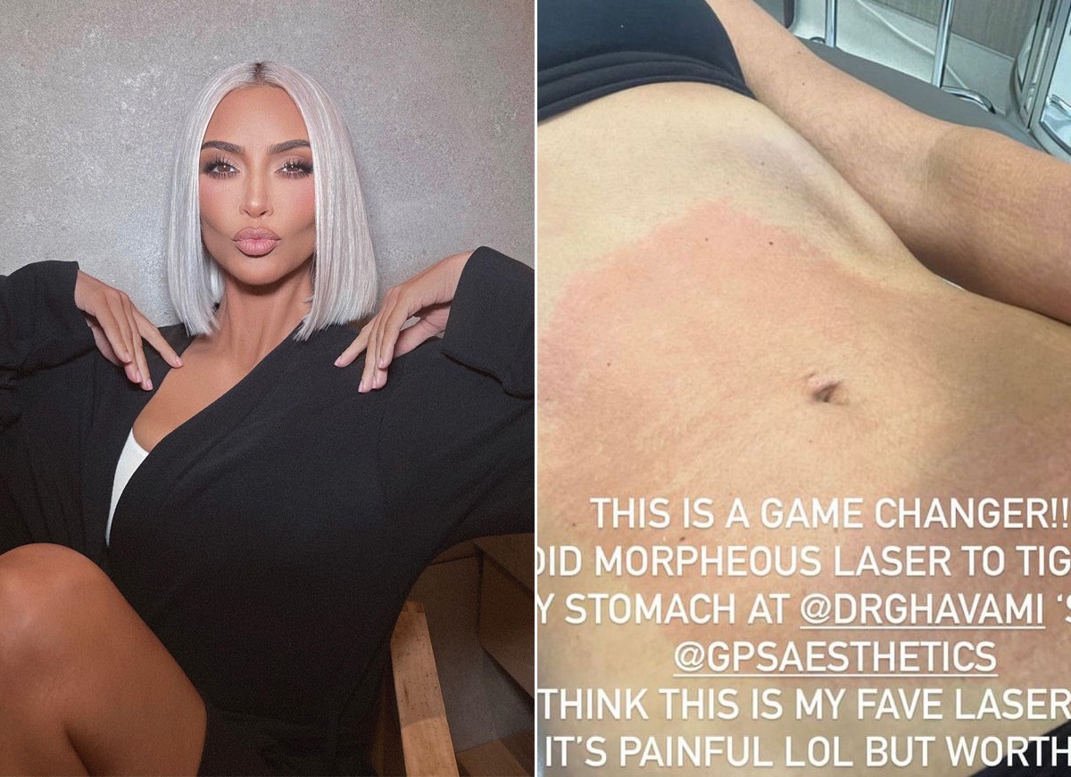 Kim Kardashian mostra tratamento doloroso para manter a barriga chapada (Foto: Reprodução / Instagram)