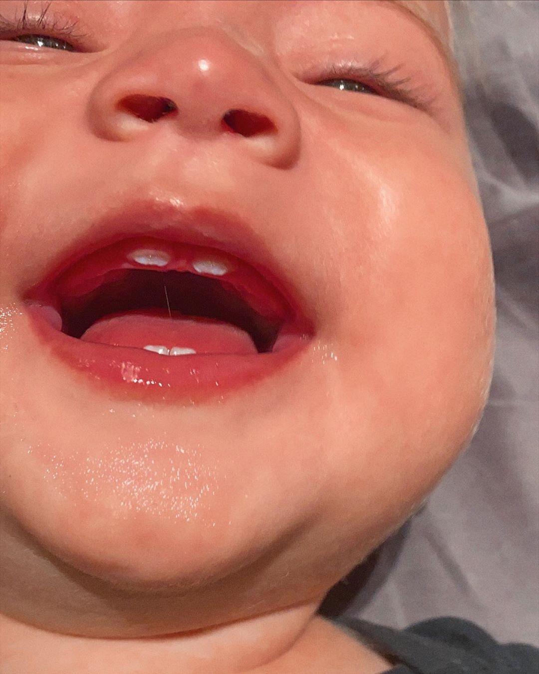 Gabi Brandt mostra o nascimento dos quatro primeiros dentes de Davi (Foto: Reprodução/Instagram)
