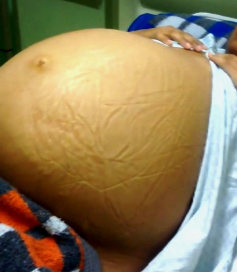Roseli Christianini Martins é confundida com mulher grávida (Foto: Reprodução/G1)