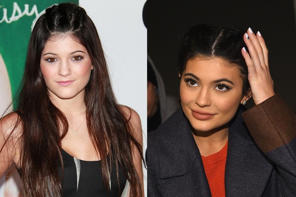 Kylie Jenner em 2010 e em 2016 (Foto: Getty Images)