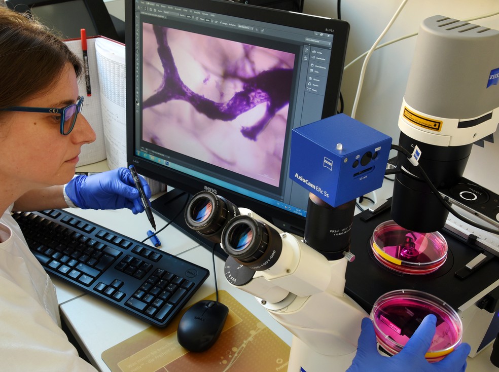 Tratamentos com células-tronco ainda não são garantidos, para médicos — Foto: Getty Images