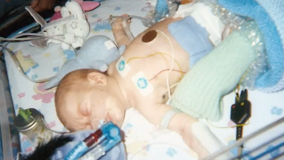 Liam Derbyshire quando bebê; pais ouviram dos médicos que o bebê não chegaria a sobreviver dois meses (Foto: Família Derbyshire)