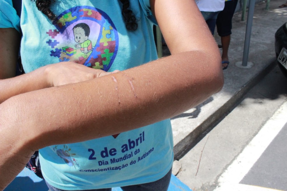 MÃ£e relata que, com ausÃªncia do medicamento, filho apresenta episÃ³dios de violÃªncia. â Foto: Eliana Nascimento/G1 AM