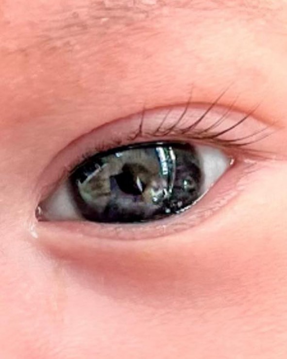 Adriana Lima publica foto do olho do filho para anunciar seu nascimento (Foto: reprodução/instagram)