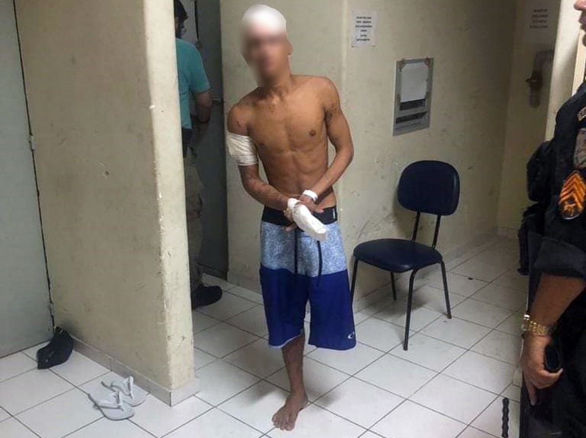 Adolescente Sem Perna Suspeito De Praticar Assaltos é Baleado E Apreendido No Rio Rio De 3648