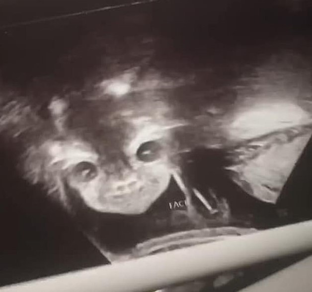 Ultrassom mostrando o rosto da bebê de Iyanna (Foto: Reprodução Facebook)