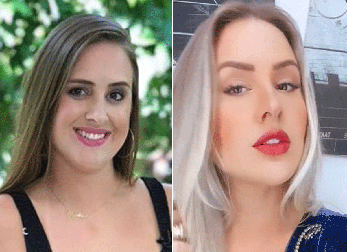 Patrícia Leitte mostra antes e depois de procedimentos estéticos (Foto: Reprodução/Instagram)