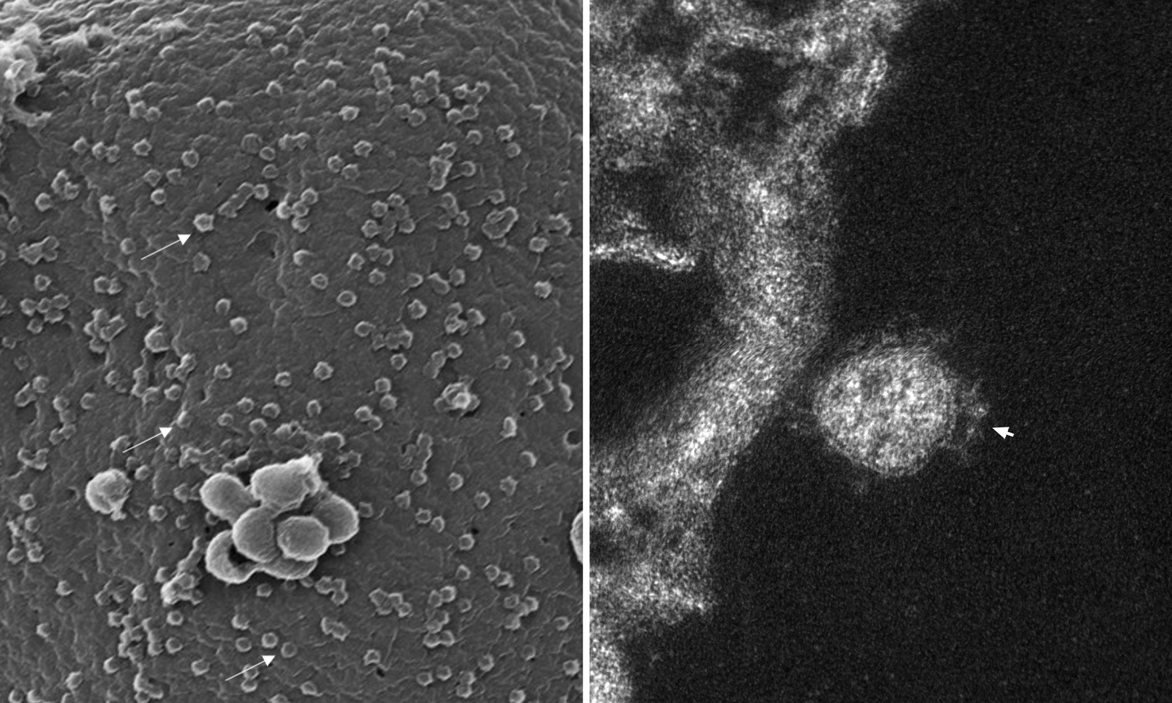 À esquerda, imagem tridimensional mostra dezenas de partículas virais aderidas à superfície celular (algumas estão indicadas por setas). À direita, um vírus aderido à membrana externa da célula. (Foto: Barreto-Vieira et al; Viruses)