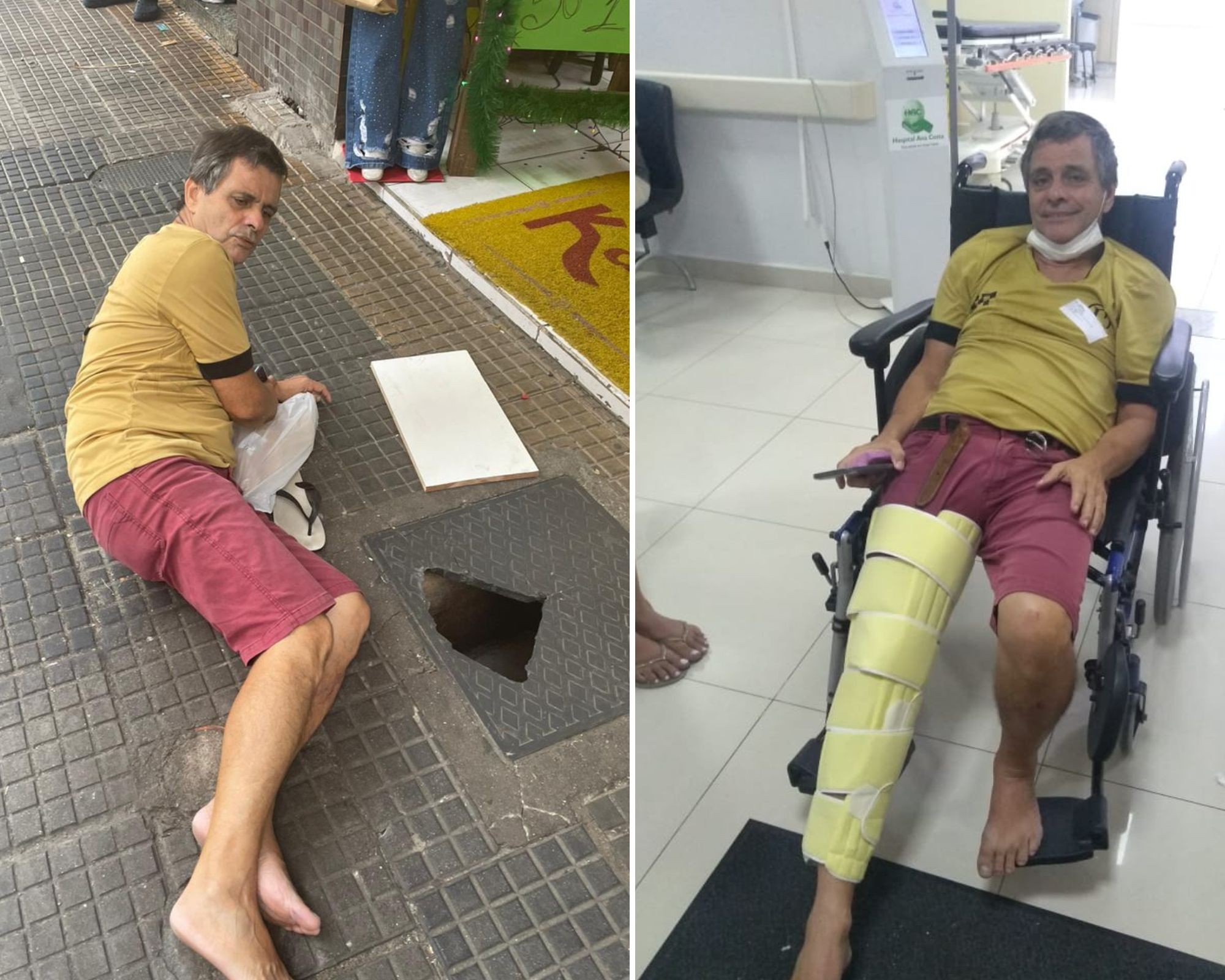 Idoso rompe o músculo da perna após cair em buraco de esgoto no litoral de SP