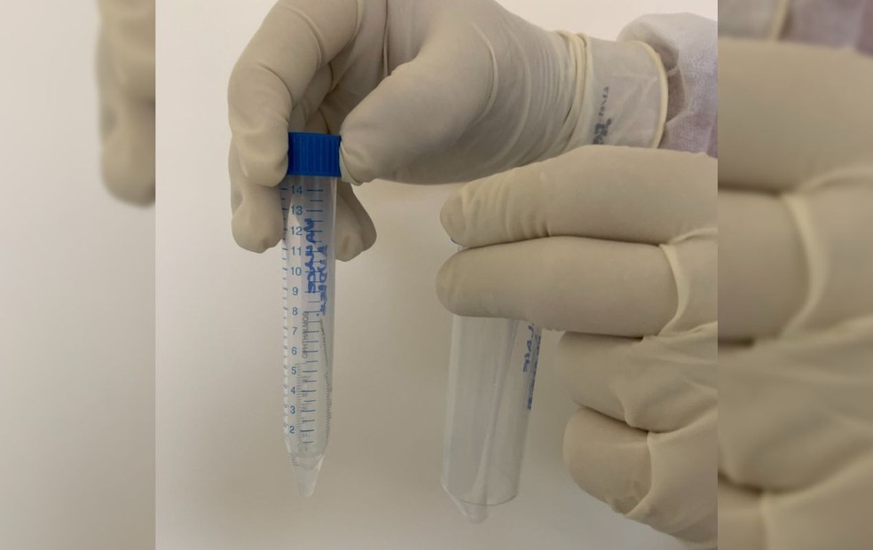 Pesquisadores da USP de Bauru descobrem que Covid-19 pode ser detectado pela lágrima — Foto: HC USP - Bauru /Divulgação