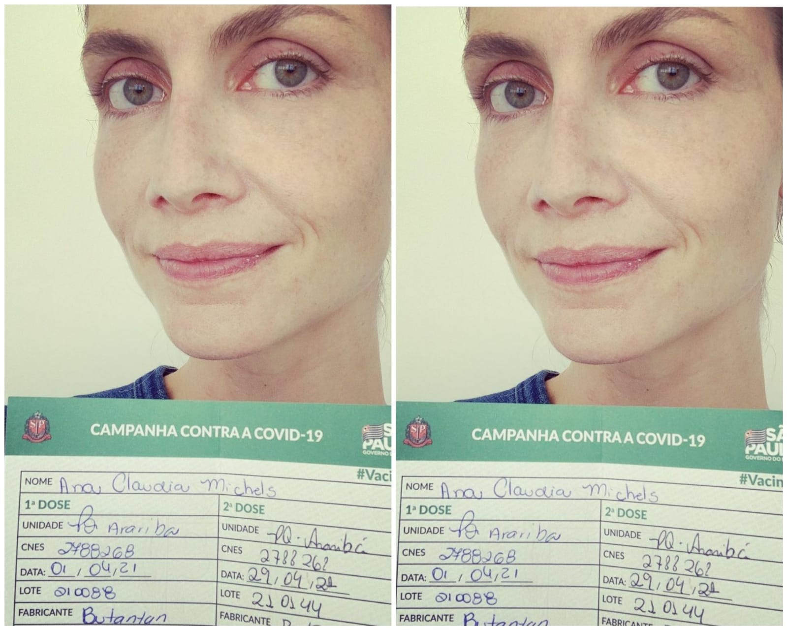 Ana Claudia Michels recebe segunda dose de Coronavac (Foto: Reprodução/Instagram)