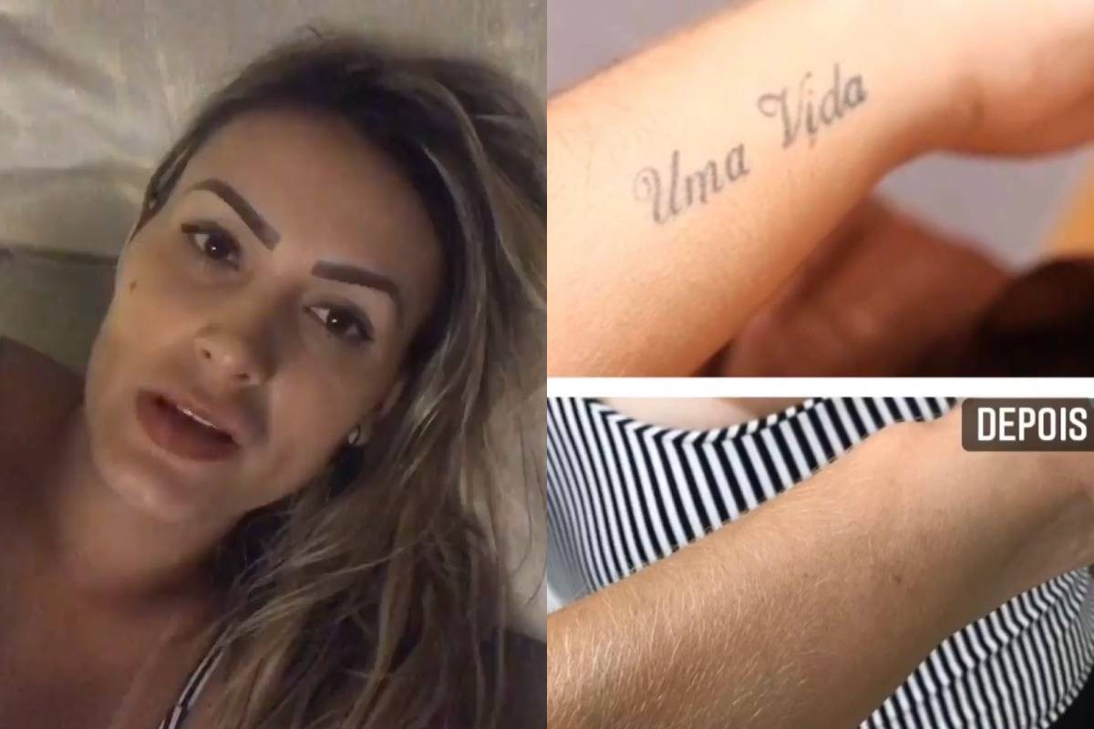 Andressa Urach mostra antes e depois de tirar tatuagens (Foto: Reprodução/Instagram)