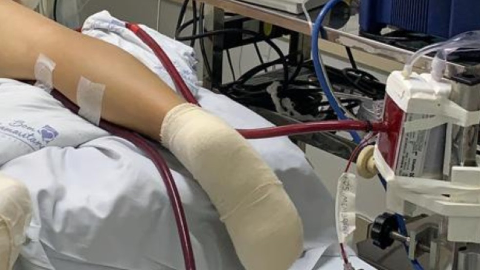 Tempo na ECMO varia de sete a dez dias, segundo médico. — Foto: Divulgação