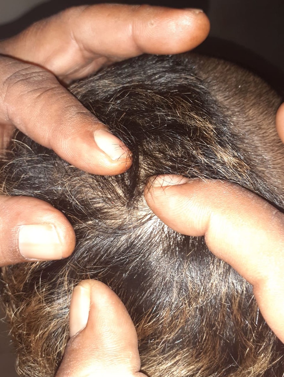 Criana teve ferimento na cabea aps agresses em Jaciara (MT)  Foto: Arquivo pessoal