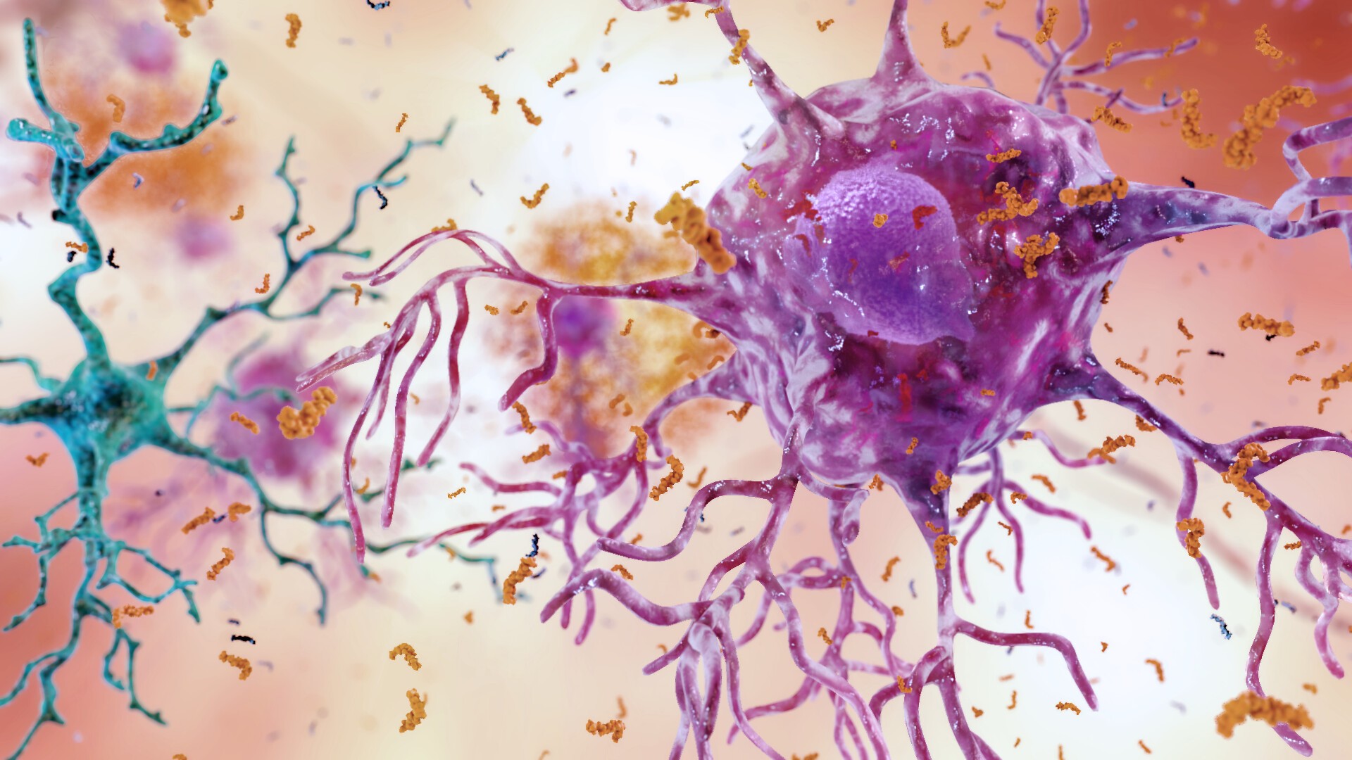 Inflamação cerebral da doença de Alzheimer pode ser causada pelo acúmulo de células gliais normalmente destinadas a ajudar a manter o cérebro livre de detritos (Foto: NIH )