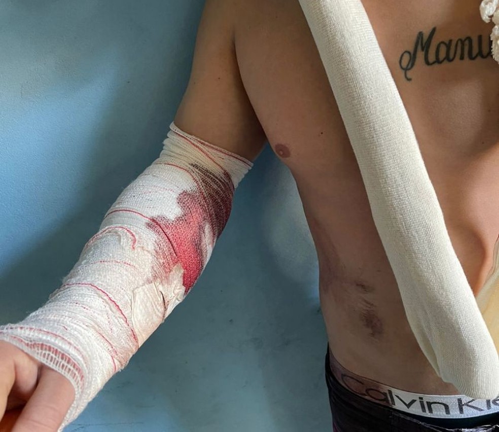 Foto mostra suspeito de participar do mega-assalto com o braço esquerdo ferido  — Foto: Arquivo Pessoal 