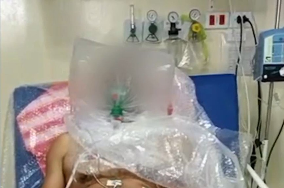 Inconsciente, paciente que aguardava vaga em UTI de hospital público do AM respirava com ajuda de saco plástico improvisado por médicos. — Foto: Reprodução/Internet