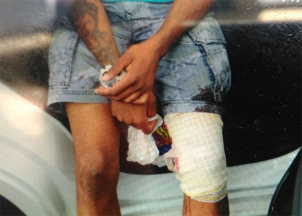 Menor apreendido foi ferido na perna por um policial civil (Foto: Ricardo Medeiros/A Gazeta)