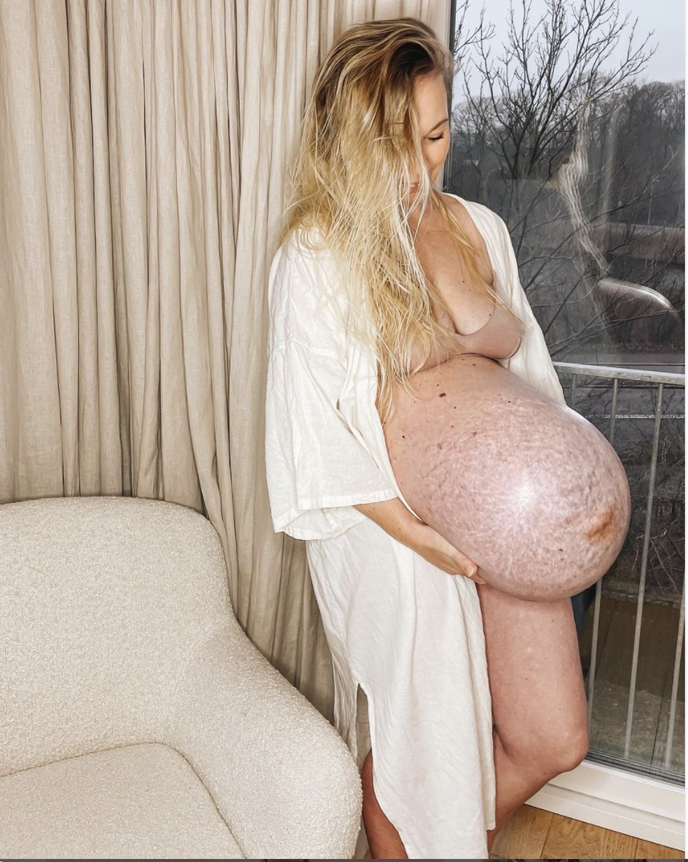 Foto mostra blogueira dinamarquesa Michella Meier-Morsi segurando a barriga durante a gravidez de trigêmeos. A diástase abdominal é mais comum quando a mulher tem gêmeos ou mais. — Foto: Reprodução/Instagram filippaophelia