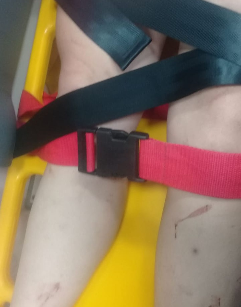 Mulher sofreu vários ferimentos pelo corpo em Duartina  — Foto: Polícia Civil / Divulgação 