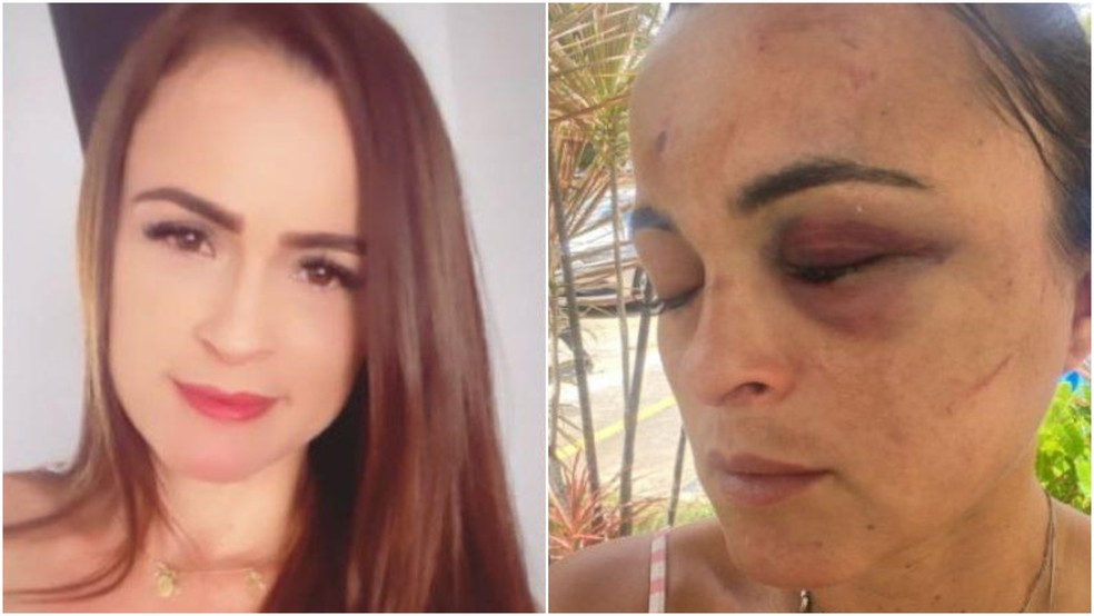 Mulher denuncia companheiro e pede medida protetiva após agressão — Foto: Arquivo pessoal