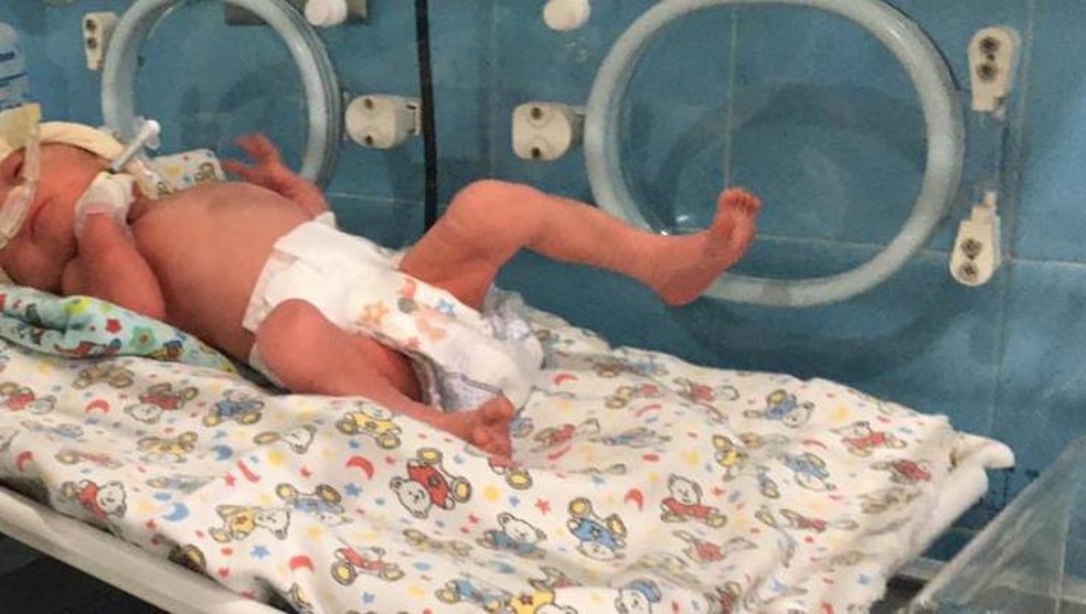 Maitê nasceu com 1,690kg vai precisar ficar em observação por 24 horas no berçário — Foto: Ascom HMS/Divulgação