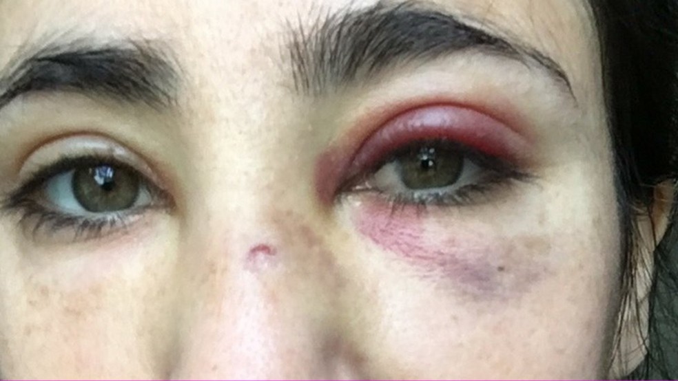 Melania Geymonat disse que nunca tinha sofrido violência física por causa de sua orientação sexual antes — Foto: Arquivo pessoal