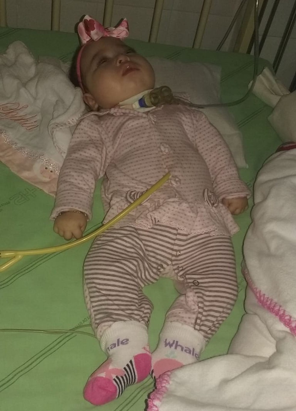 Menina já passou por dois processos cirúrgicos. (Foto: Josis Meng)