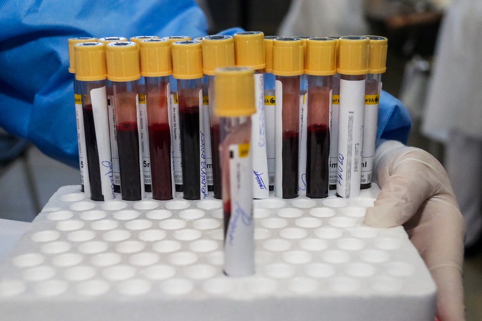 Tubos de exame de sangue para teste da Covid-19 em Sorocaba, no estado de São Paulo — Foto: Cadu Rolim/Estadão Conteúdo