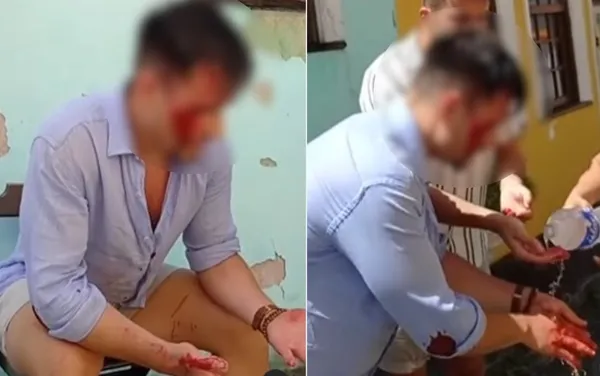 Turistas foram atendidos pela Samu e levados para hospital — Foto: Redes sociais