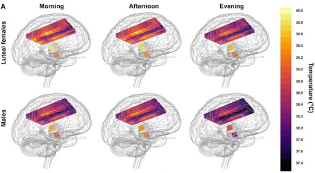 Variação da temperatura cerebral de homens e mulheres ao longo do dia  (Foto: MRC Laboratory)