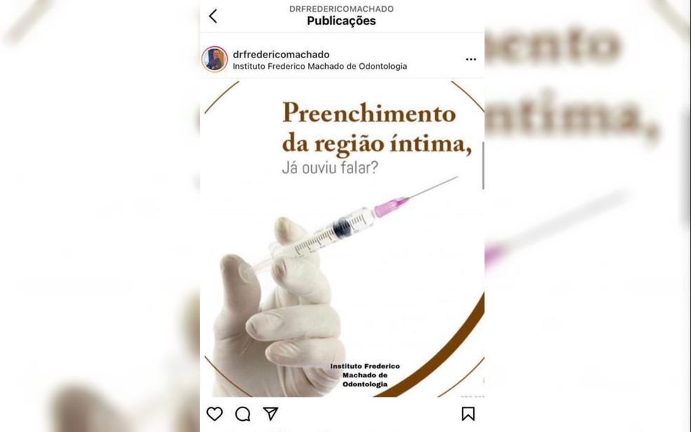 Procedimento anunciado nas redes sociais de dentista proibido de exercer a profissão por 30 dias, em Goiânia, Goiás — Foto: Reprodução/TV Anhanguera