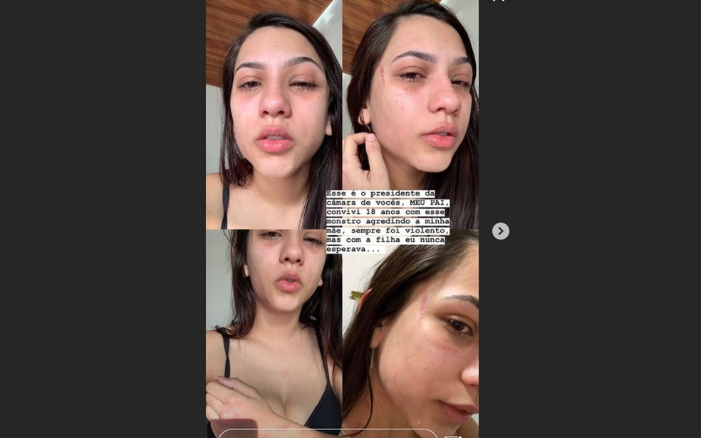 Filha de presidente de Câmara na BA denuncia nas redes sociais agressões físicas feitas pelo pai: 'Meu olho está roxo' — Foto: Reprodução / Redes Sociais 