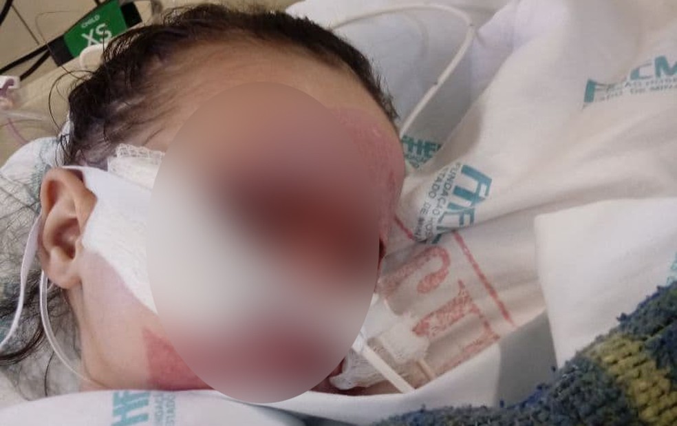 Avo Sonha Rever Rostinho Angelical E Diz Que Bebe Queimado Em Hospital Nao Tem Previsao De Alta Minas Gerais G1