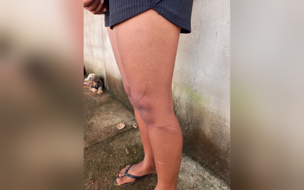 Adolescente que teve cabelo raspado por namorado apresentava ferimentos em todo o corpo, em Nova Iugaçu de Goiás — Foto: Reprodução/Polícia Militar
