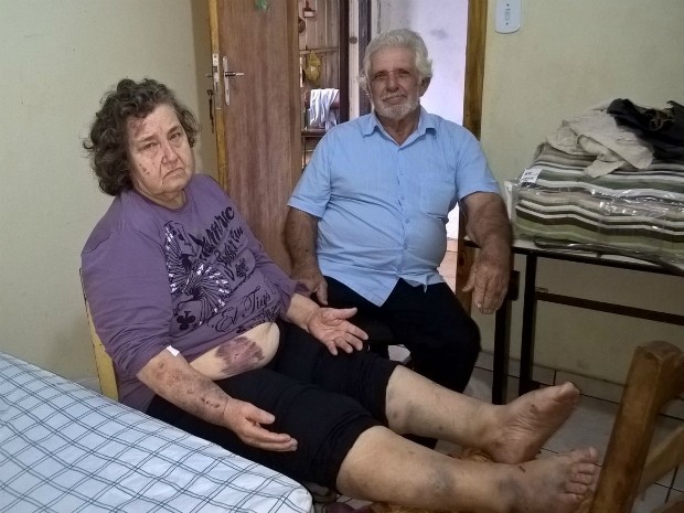 Izolete Soares, de 65 anos, ficou bastante ferida e deixou o hospital na terça (14); ela e o marido, o aposentado Antônio Soares, de 78 anos, tiveram a casa destruída pelo tornado (Foto: Josiane Soares Sai / Arquivo Pessoal)