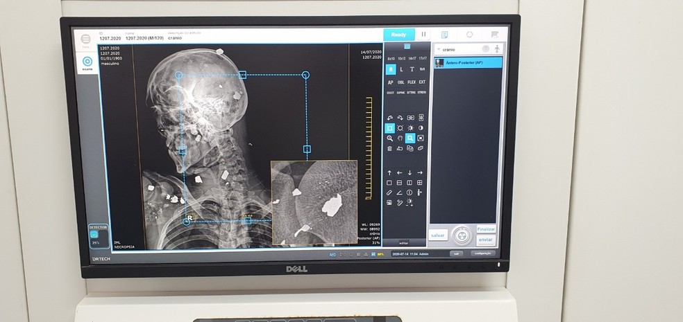 Software adotado pelo IML de Maceió examina corpos em imagens de alta definição — Foto: Ascom/Perícia Oficial