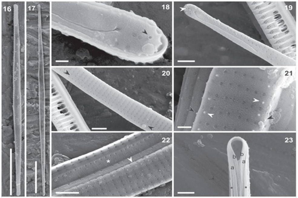 Alga em microscópio eletrônico — Foto: Reprodução